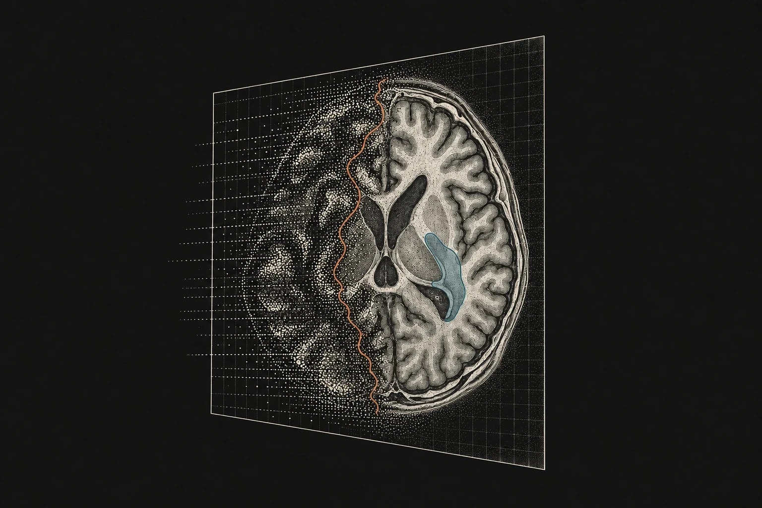 Engraved illustration of an MRI slice being reconstructed and segmented