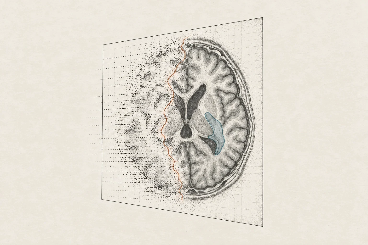 Engraved illustration of an MRI slice being reconstructed and segmented